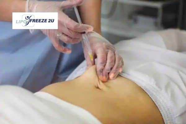How Does Aqualyx Fat Dissolving Injection Work to Break Down Fat Henley-on-Thames?