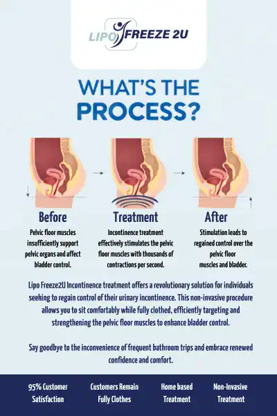 Diagram of how incontinence treatment Henley-on-Thames works.