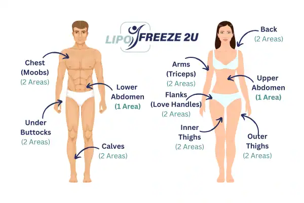 Areas you can have fat freezing treatment Henley-on-Thames