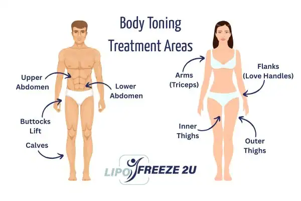 Graphic showing where you can have Body toning Treatment Henley-on-Thames on your body