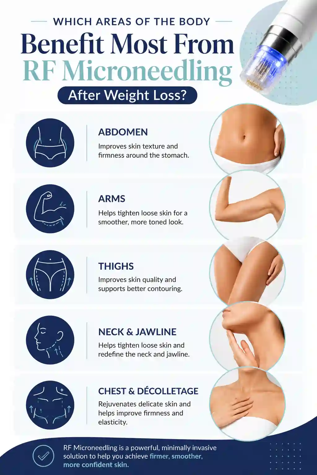 Which Areas of the Body Benefit Most From RF Microneedling After Weight Loss Henley-on-Thames